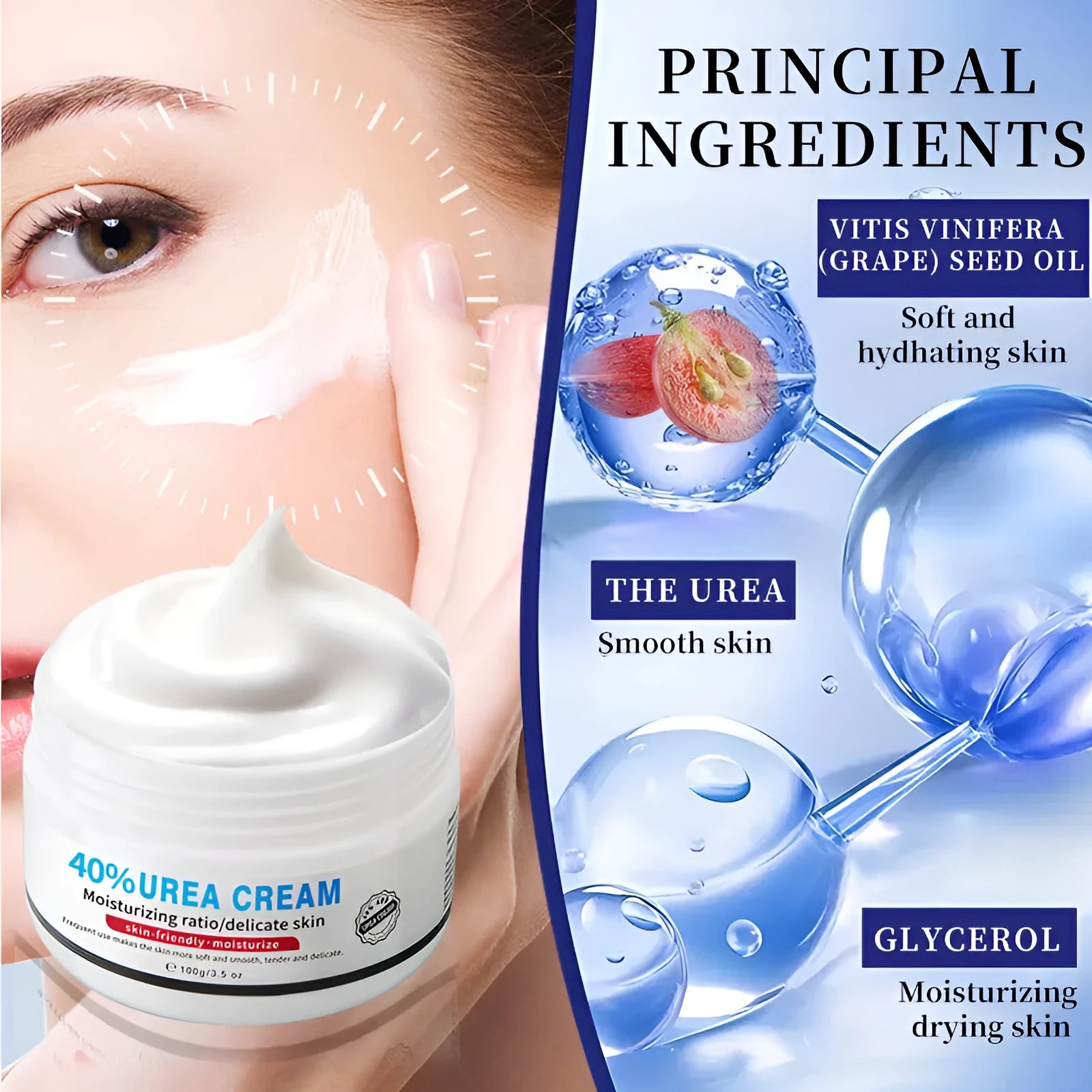 100g Urea Cream for chicken skin replenishment and dry skin improvement in standard packaging