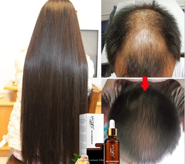 Senna Hair Growth Fluid 30ml brown liquid bottle with botanical fragrance for thinning hair treatment