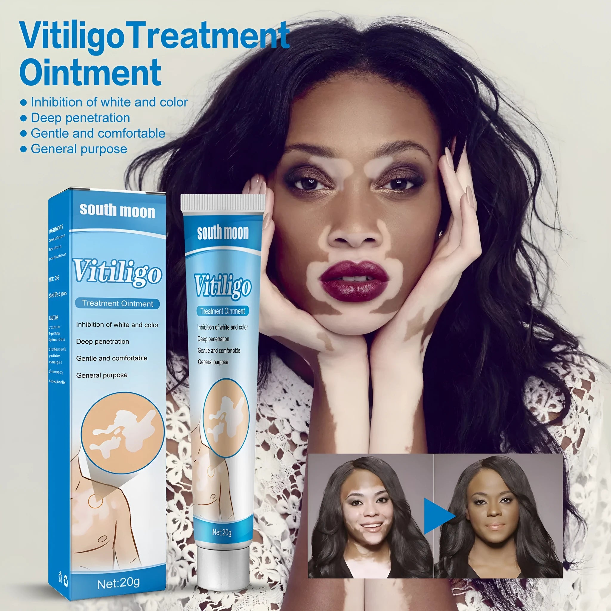 White box containing Flower Spot Sweat Spot White Cream 20g tube for dark spot treatment.