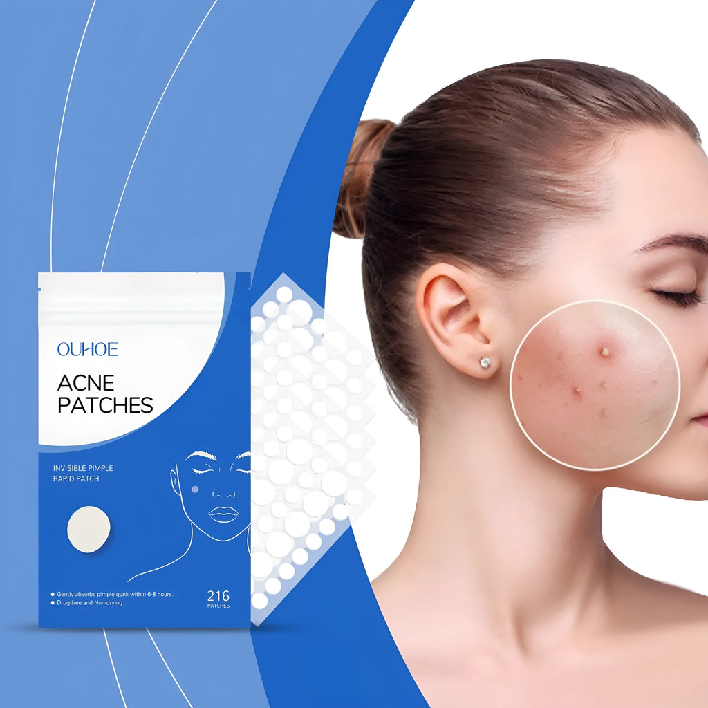 216-count acne patches with tea tree oil and vitamin E for gentle facial spot treatment