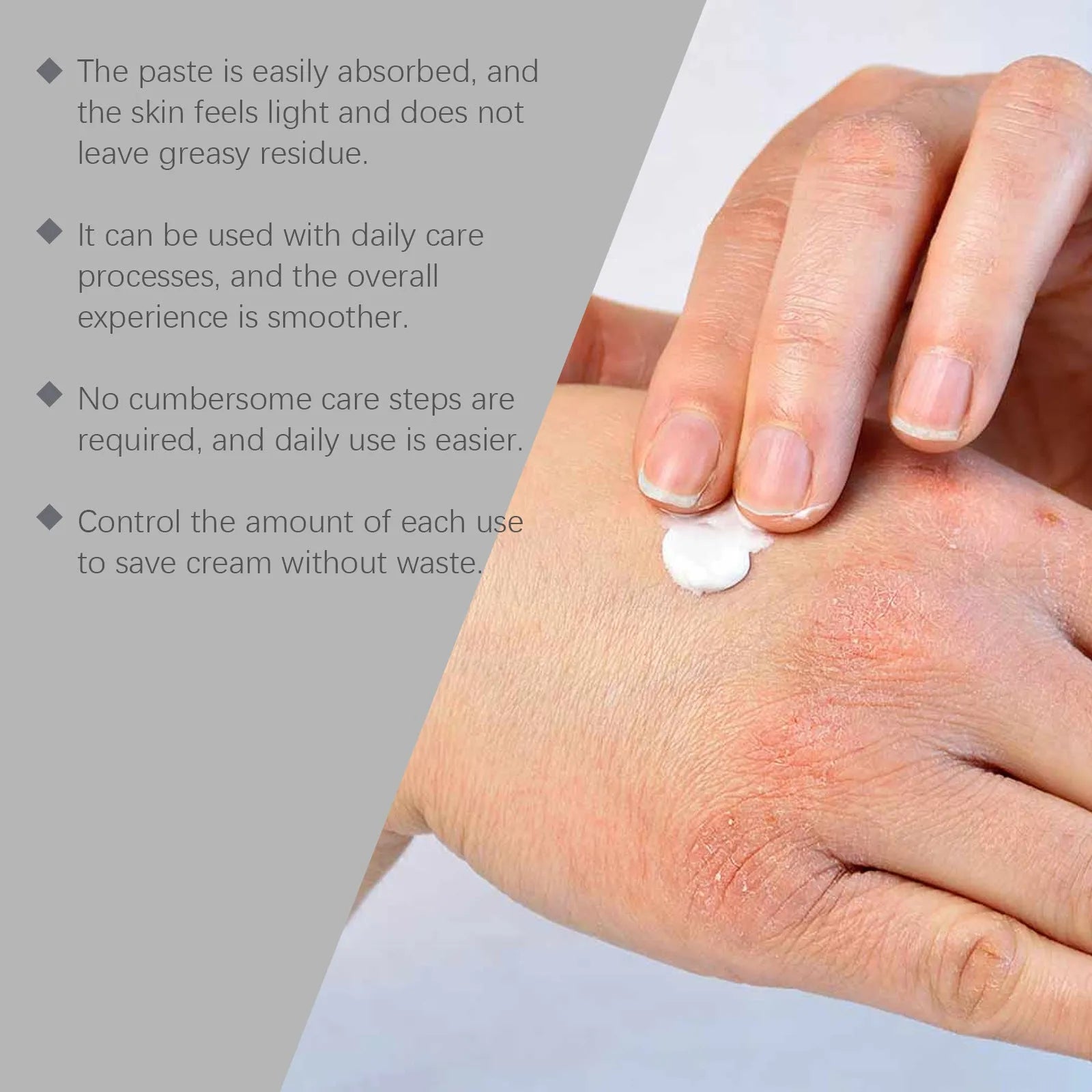 75g tube of gentle skin neck cream with bifidobacterium and mint leaf for soothing.