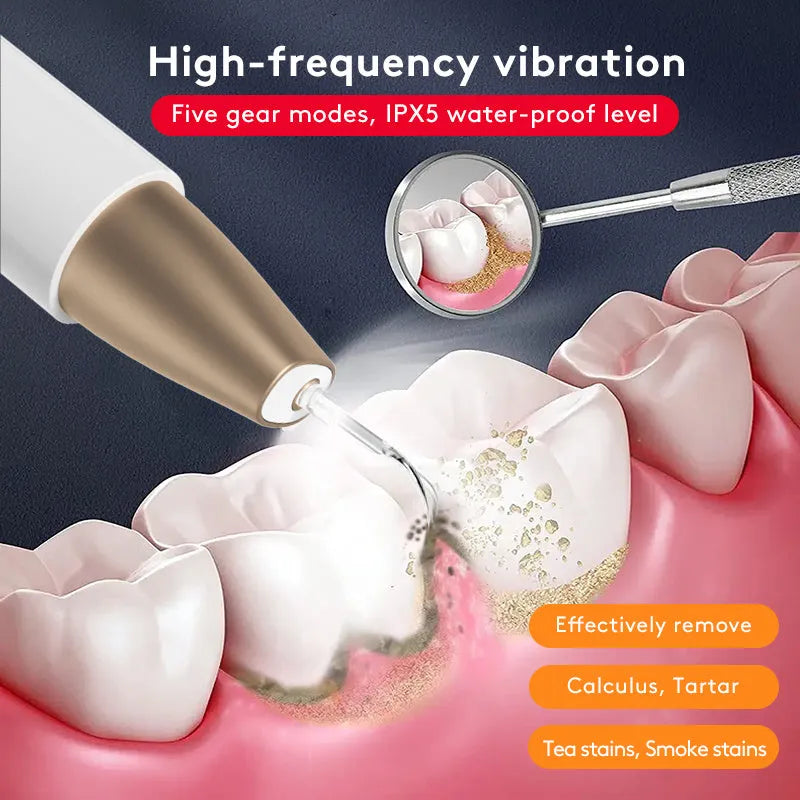 Gold ultrasonic tooth cleaner and tartar remover device for oral care