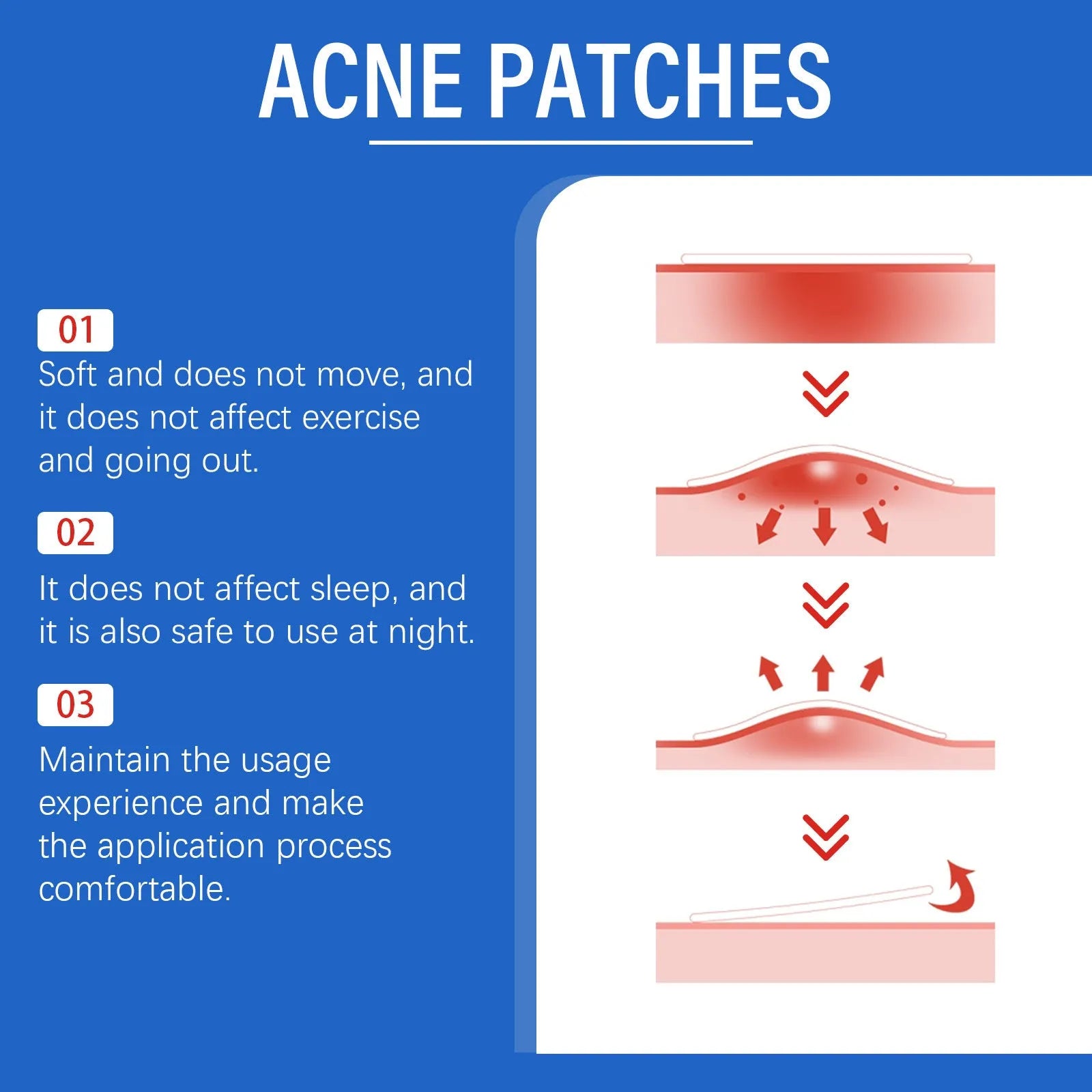 216-count acne patches with tea tree oil and vitamin E for gentle facial spot treatment