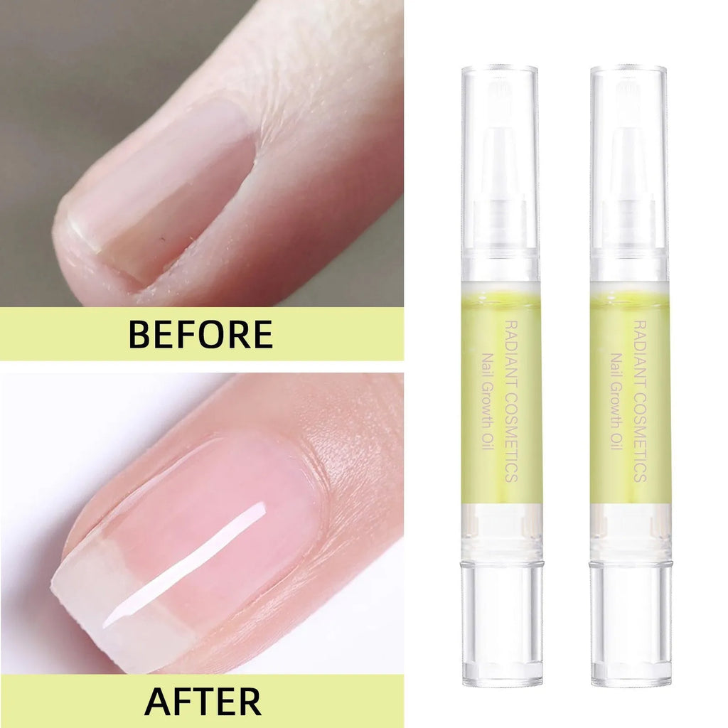 3ml nail growth oil bottle for export with wash-free treatment formula