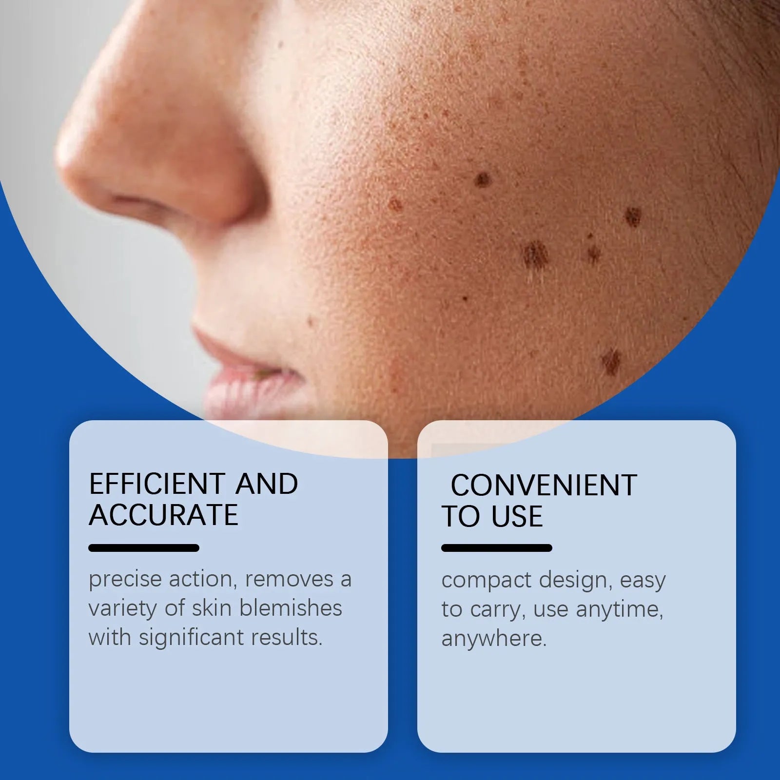 Mole and wart removal laser pen with ABS plastic construction for skin care treatment