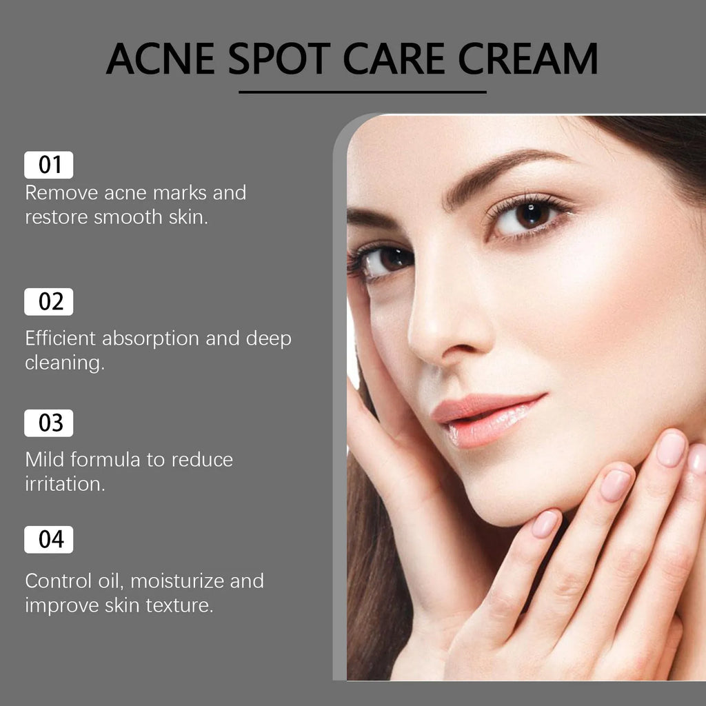 15g container of hydrating acne cream with mint, tea tree oil, and aloe leaf extracts