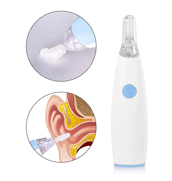 Rotating earwax vacuum cleaner with spiral silicone head, blue, with LED light and multiple attachments