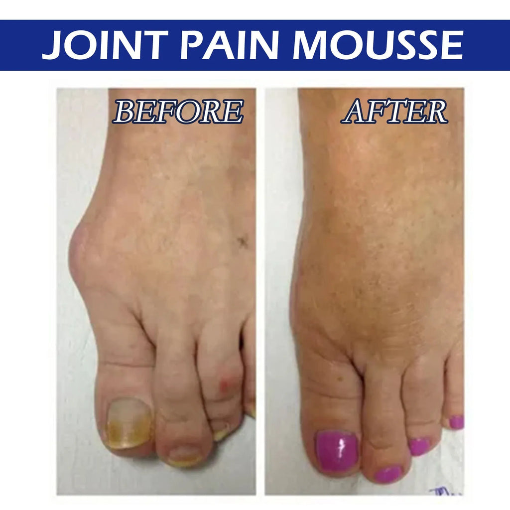 15ml bottle of herbal massage drops for sore muscle and joint relief