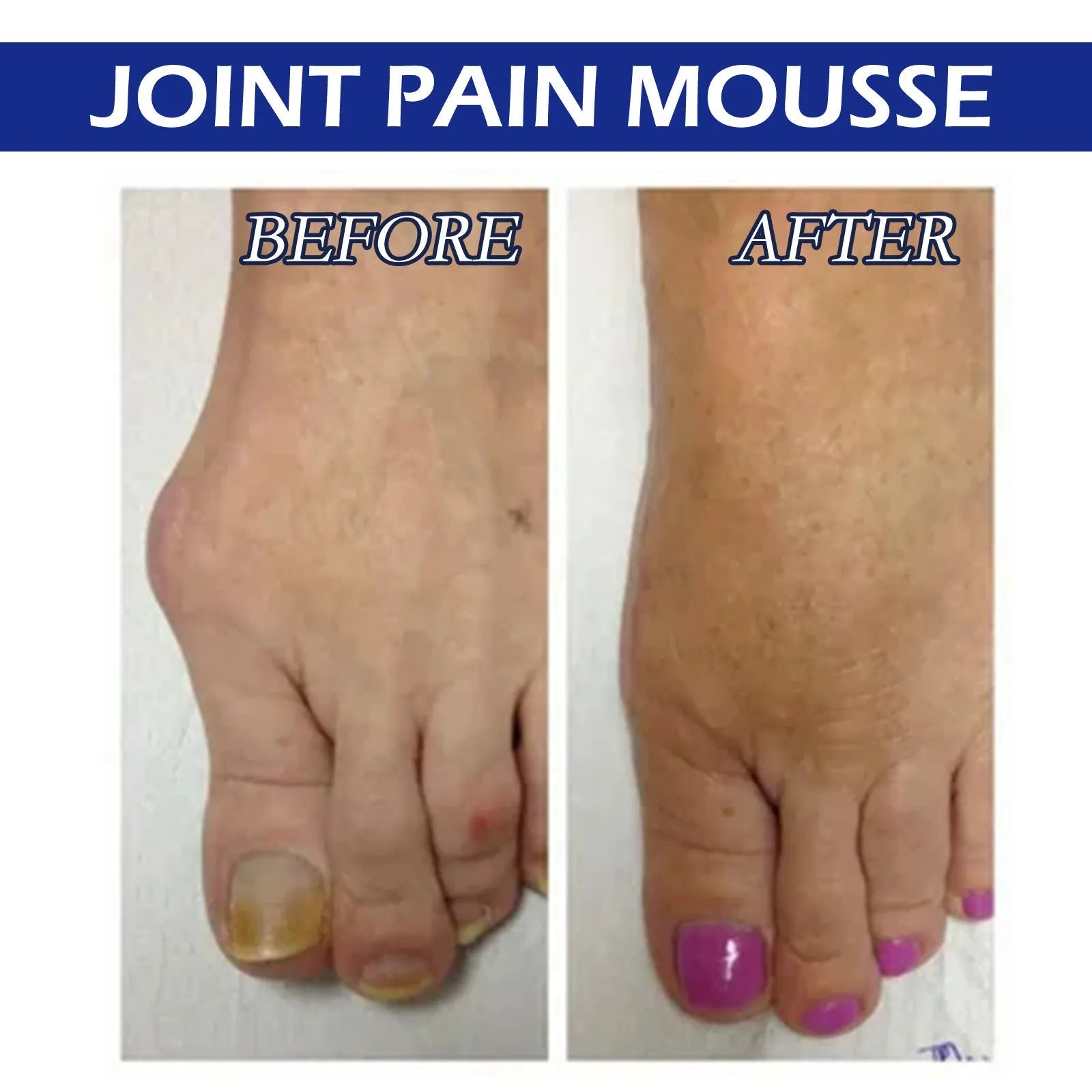 15ml bottle of herbal massage drops for sore muscle and joint relief