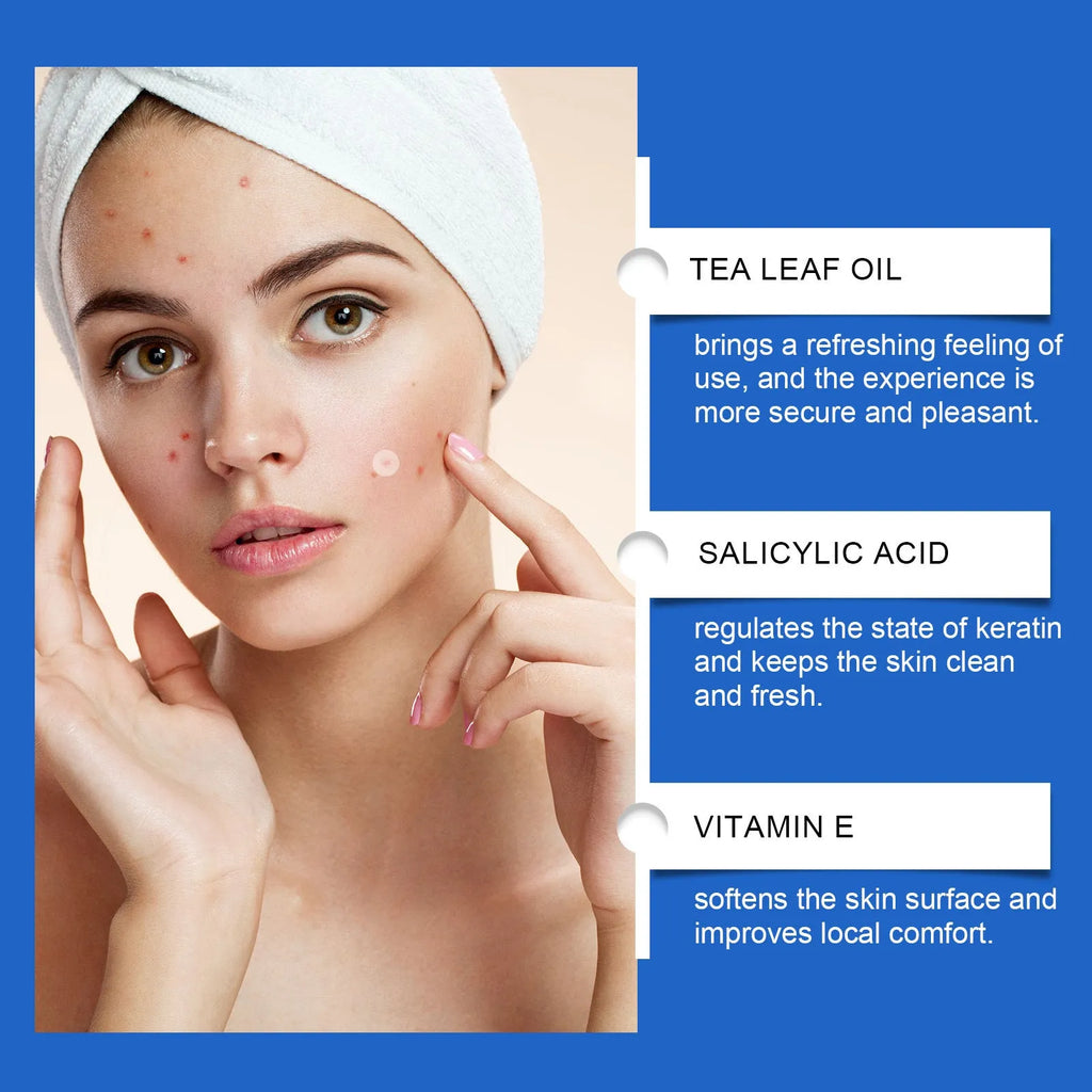 216-count acne patches with tea tree oil and vitamin E for gentle facial spot treatment