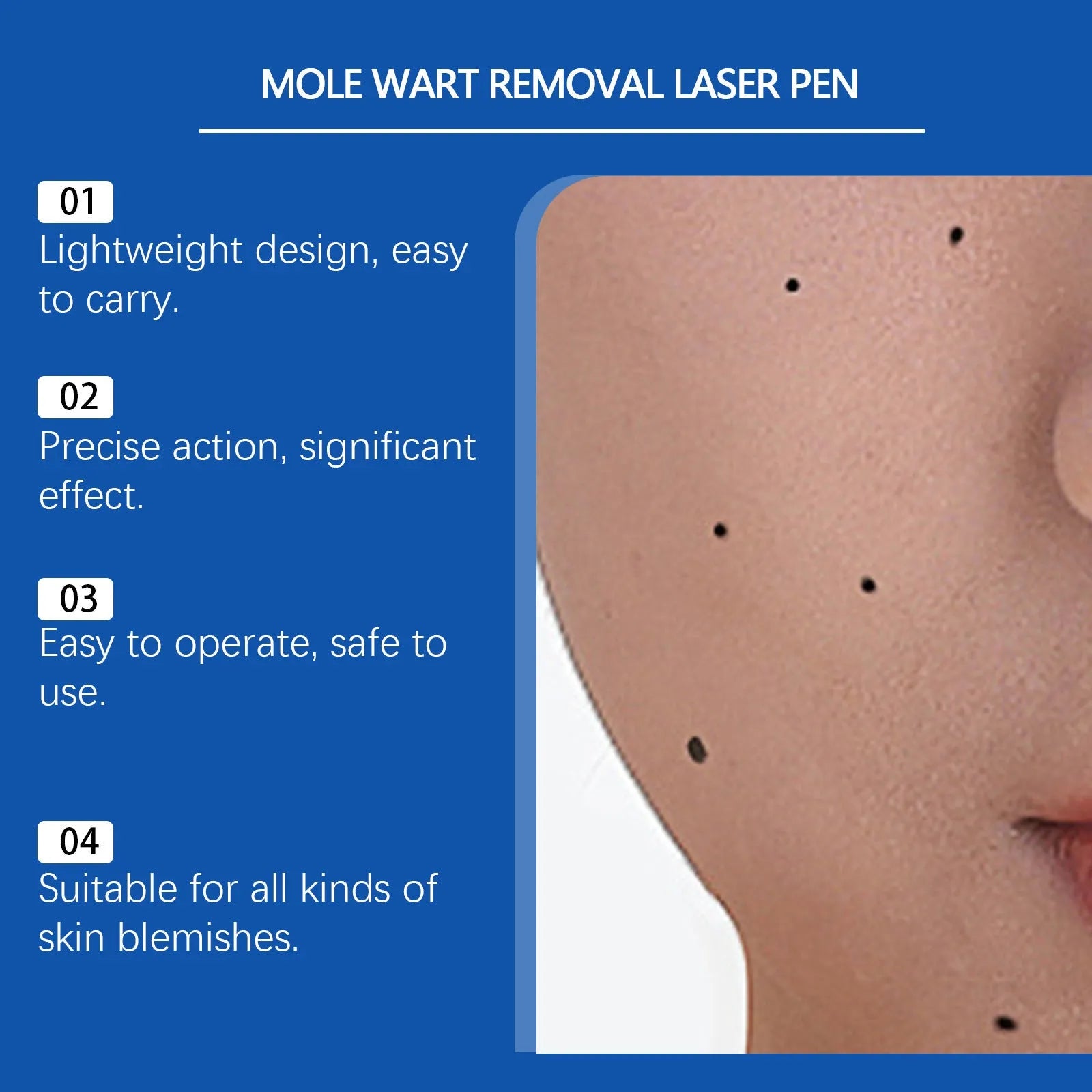 Mole and wart removal laser pen with ABS plastic construction for skin care treatment