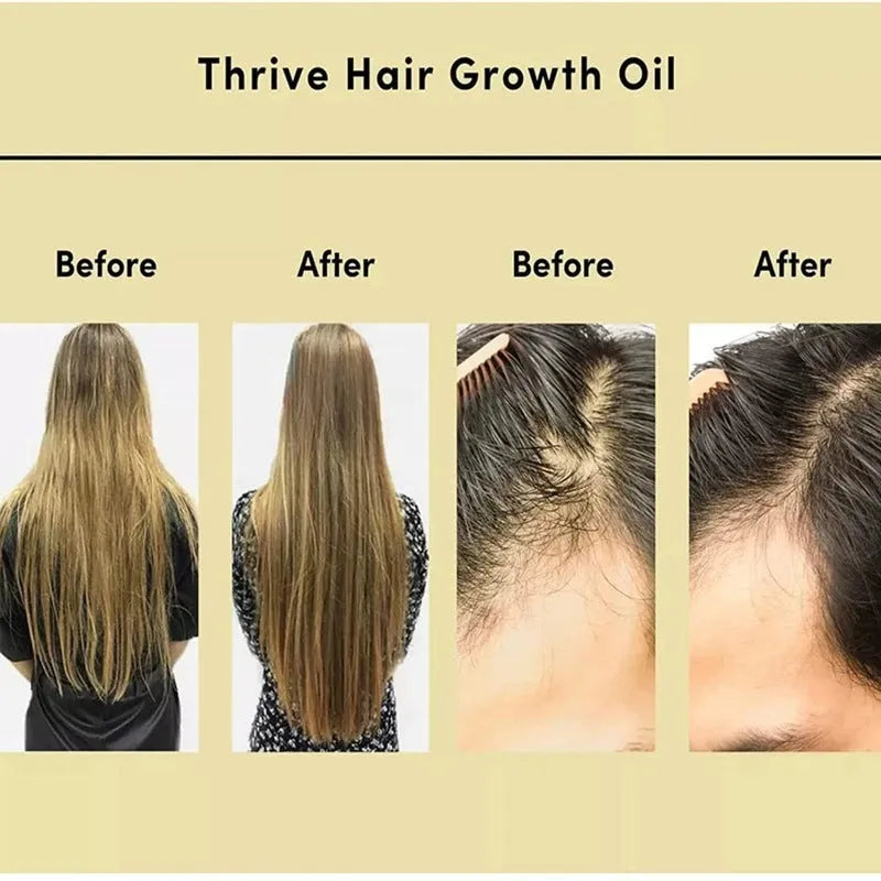 Yellow rosemary essential hair oil in a 60ml bottle for damaged and frizzy hair care.