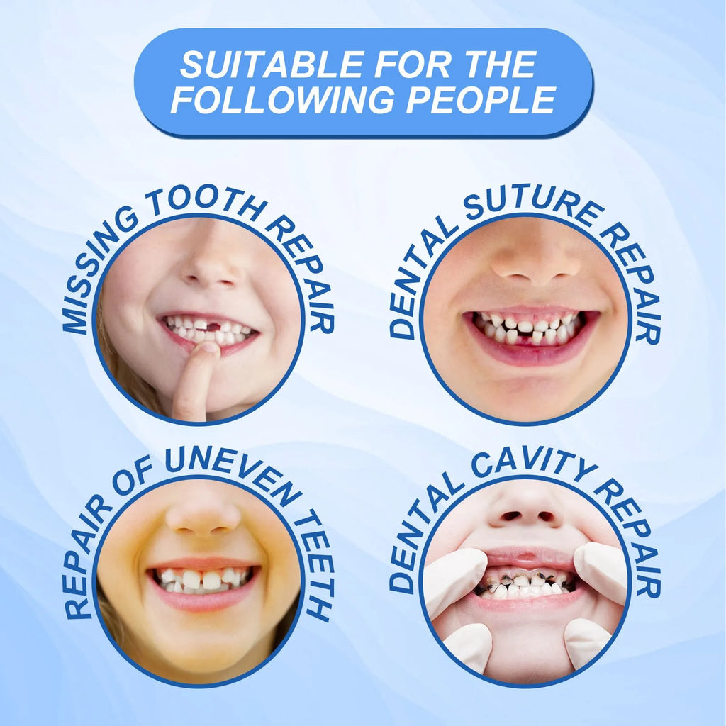 30ml disposable plastic solid teether particles teeth joint filling glue for adult temporary dental repair