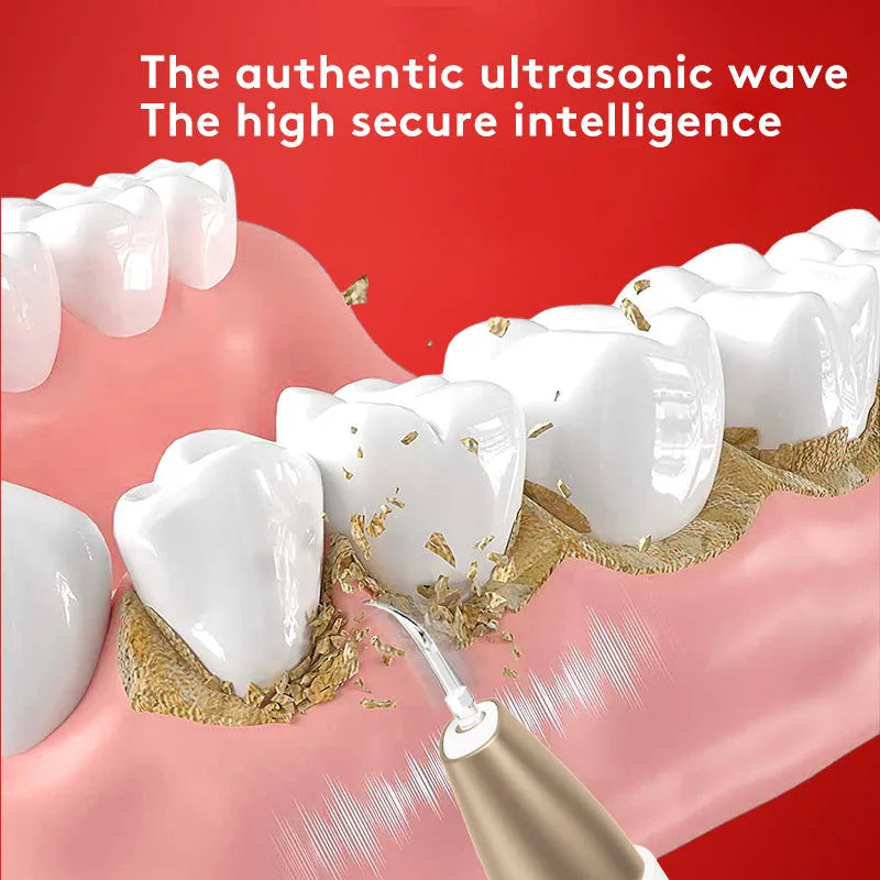 Gold ultrasonic tooth cleaner and tartar remover device for oral care