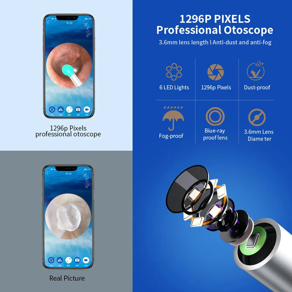 NE3 wireless ear cleaner otoscope with camera LED light in black or white colour